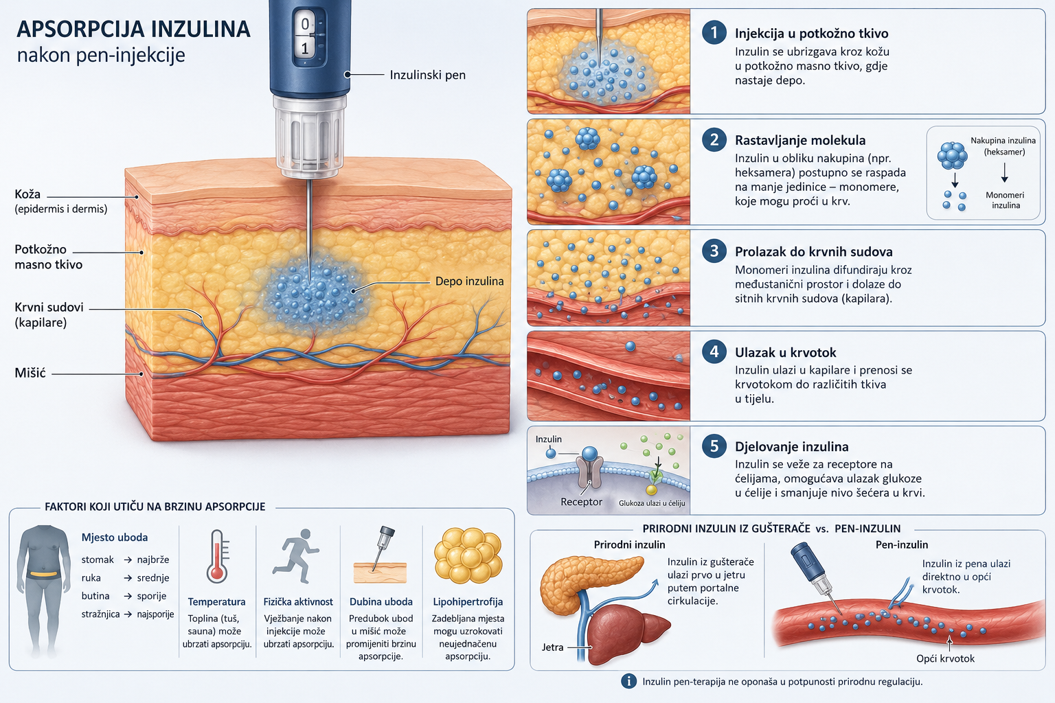 Infografika apsorpcije inzulina – 5 koraka, faktori koji utiču na brzinu, i poređenje prirodnog inzulina sa pen-inzulinom