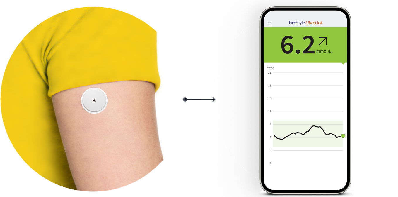 Freestyle Libre 3